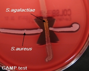 Streptococcus Agalactiae Under Microscope, Group B Streptococcus Or GBS ...